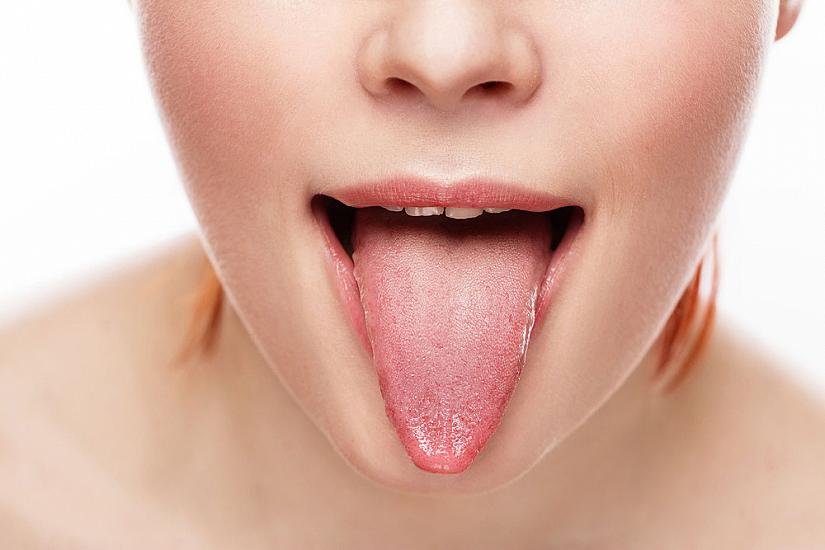 рак на езика снимки